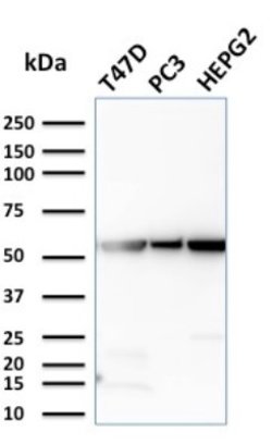 Glucose 6 phosphate isomerase, Mouse anti-Human, Clone: CPTC-GPI-1, Novus